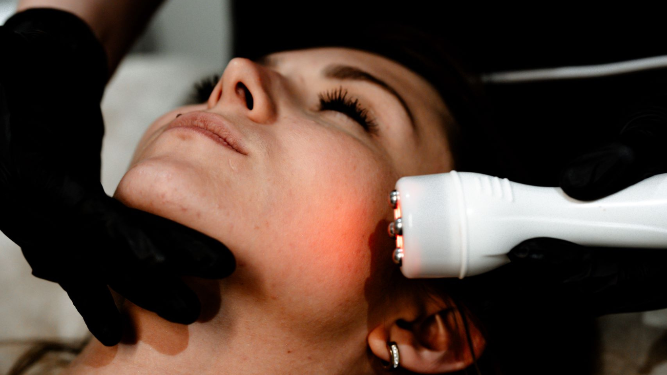 Radiofréquence visage à Toulouse – Soin anti-âge chez Dermo Innovation Femme recevant un soin de radiofréquence visage à Toulouse dans l’institut Dermo Innovation