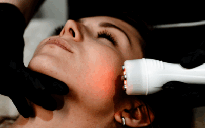 Radiofréquence visage à Toulouse : un soin anti-âge naturel et efficace